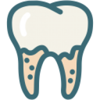 Cavities