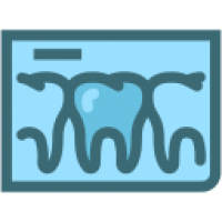 Dental X-Rays